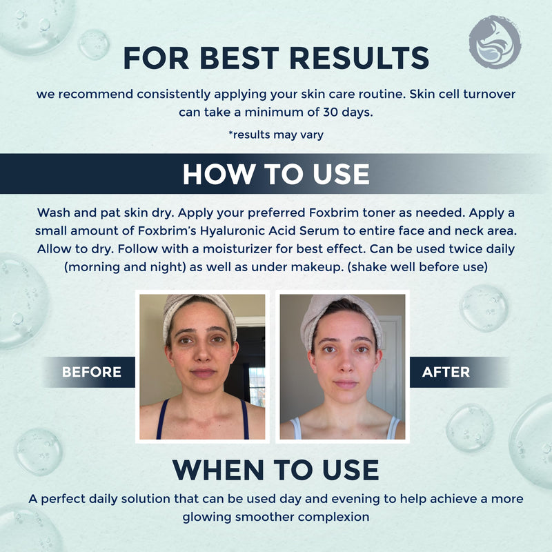 Hyaluronic Acid Face Serum - Hydrating Anti Wrinkle Anti Aging Facial Serum - With Vitamin C and E, Green Tea, Jojoba Oil - Natural and Organic - 1 Oz by Foxbrim Naturals Hyaluronic Acid Serum