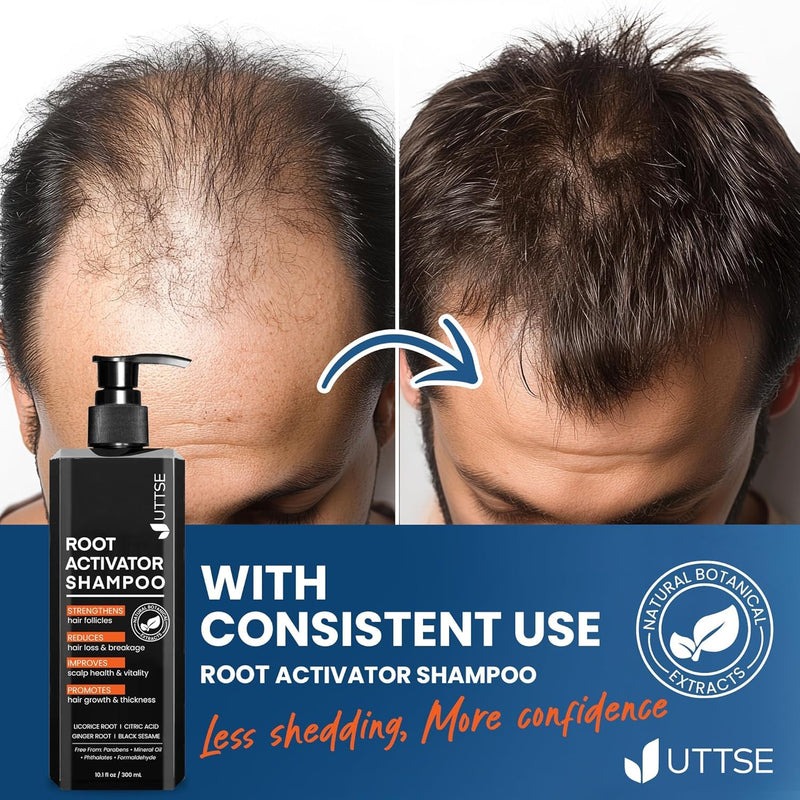 Root Activator Shampoo: Hair Growth Shampoo for Hair Loss and Thinning Hair