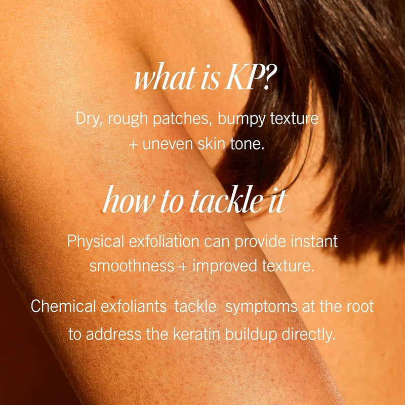 [Australia] - First Aid Beauty - KP Bump Eraser Body Scrub with 10% AHA, Keratosis Pilaris Skin Exfoliater with Glycolic and Lactic acids, Helps Reduce Chicken Skin Bumps, Safe for Sensitive Skin, 10 oz 10 Ounce (Pack of 1) 