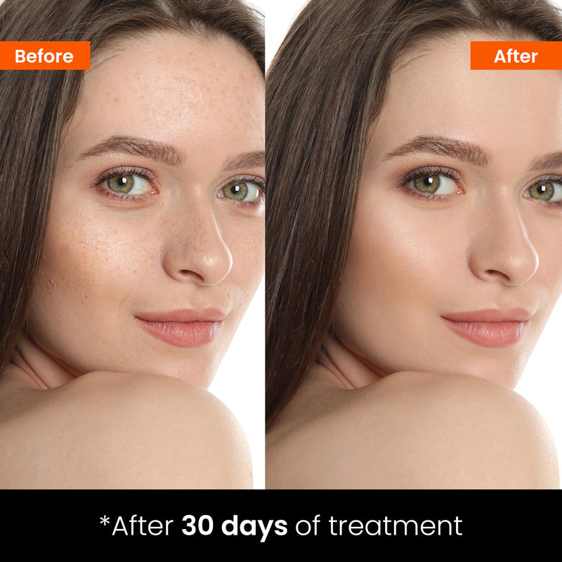 Creamy Vitamin C Face Serum, 10% Vitamin C, Serum for Glowing and Radiant Skin, Even Skin Tone, Prevent Premature Aging, All Skin Types, 1 fl oz/30mL