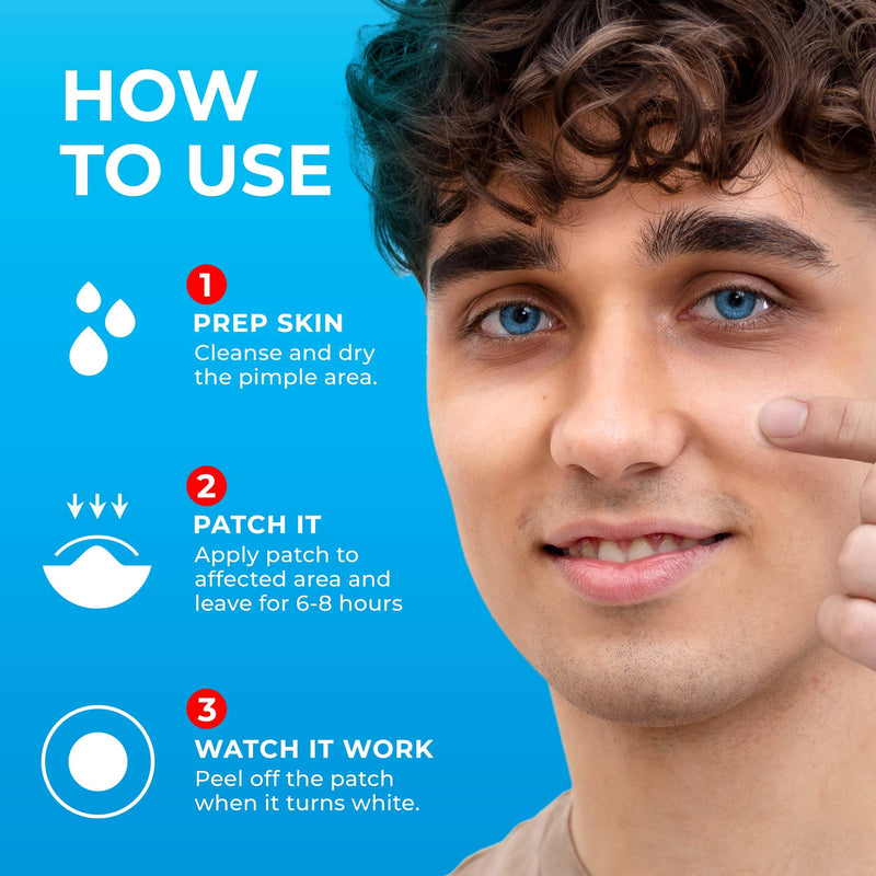 [Australia] - KEYCONCEPTS Pimple Patches for Face (120 Patches), Hydrocolloid Acne Patches with Tea Tree Oil, Pimple Patch Pimple Stickers - Hydrocolloid Patch Acne Dots - Acne Pimple Patches For Face - Zit Patches Hydrocolloid and Tea Tree 1 Count (Pack of 120) 