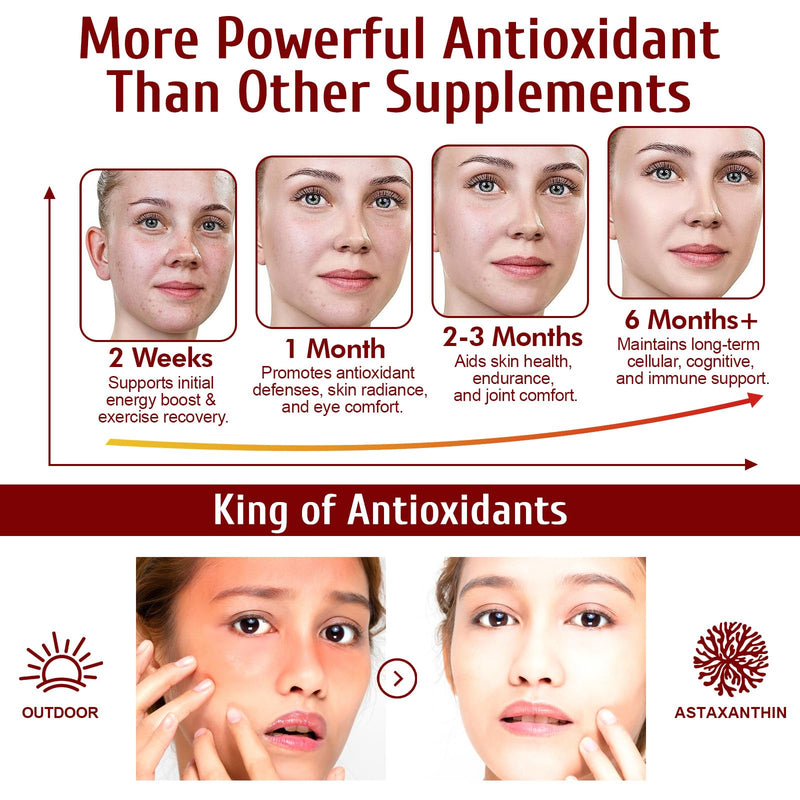 [Australia] - Astaxanthin 12mg - 120 Softgels - 4 Month Supply - Organic Astaxanthin Antioxidant Supplements Supports Eye, Joint, Internal Circulation and Skin Health - Non-GMO 