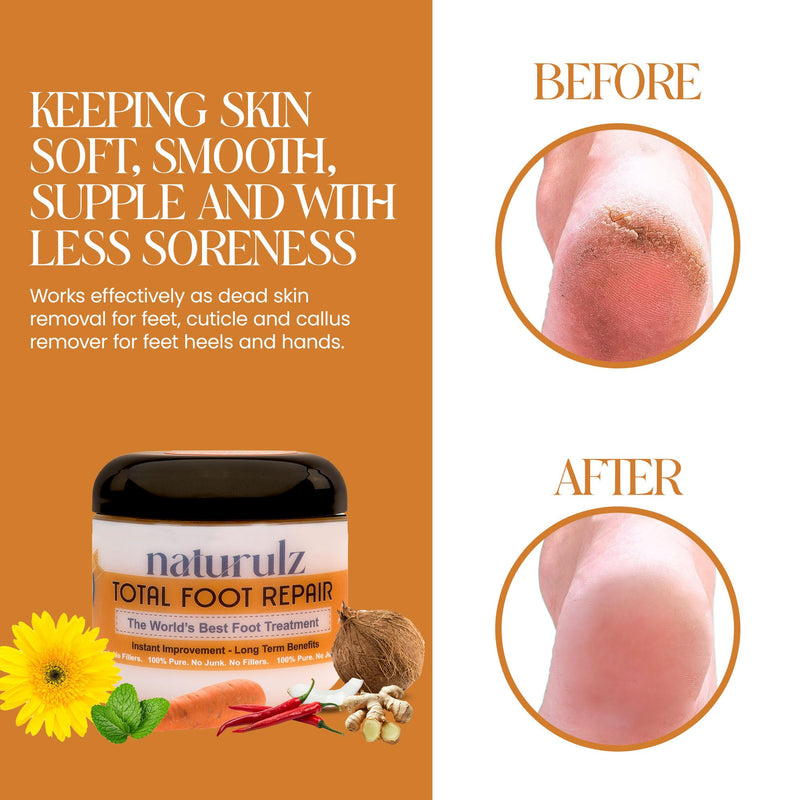 [Australia] - Naturulz Total Foot Repair 4oz – No Junk Foot Cream for Dry, Rough Skin & Cracked Heels, Lightweight & Compact Moisturizer for Feet, Knees, Elbows & Hands, Softens, Repairs & Smooths Cracked Skin 
