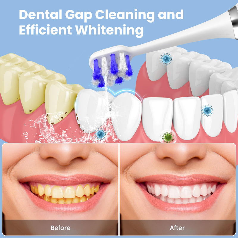 [Australia] - Portable Water flosser with Electric Toothbrush, 2 in 1 Teeth Cleaning Kit, Electric Toothbrush and flosser Combo, Water Flosser for Travel and Home (White) White 