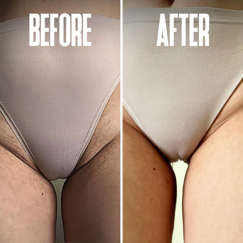 [Australia] - Prevent Ingrown Hairs and Razor Bumps with BHA & AHA Pads - Ingrown Hair Serum for Razor Burns, PFB Razor Bump Stopper Topicals Skin Care, Ingrown Hair Treatment for Bikini Area and Razor Bumps 50pads 