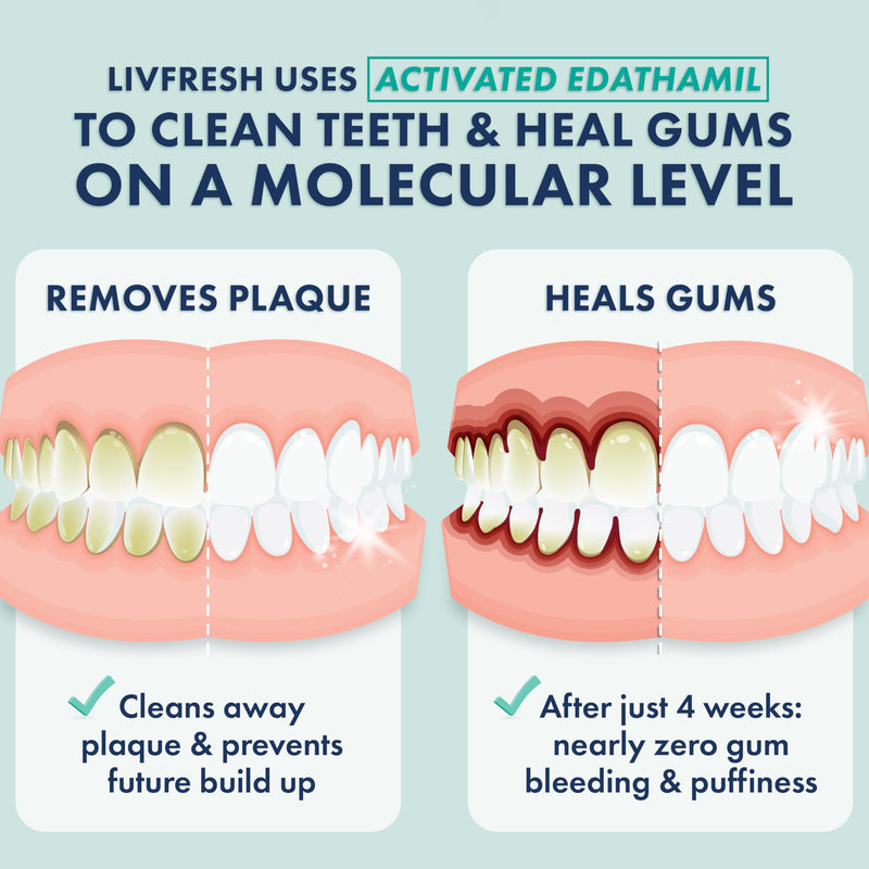 LIVFRESH Toothpaste Gel, Clinically Proven to Remove Plaque 250% Better, Improves Gum Health 190% Better, Prevents & Reduces Tartar, Freshens Breath, SLS Free Dental Gel, Wintergreen Wintergreen, Foaming, Whitening 1.75 Ounce (Pack of 1)