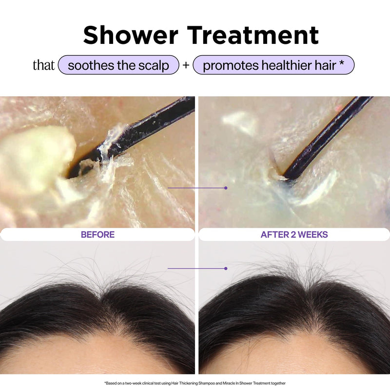 Dr. Groot Miracle in Shower Moisturizing Treatment for Hair Loss, Korean Hair Care Rinse, Rosemary Oil for Smooth, Healthier-Looking Hair in 5 Seconds, Scalp Revitalizing Solution
