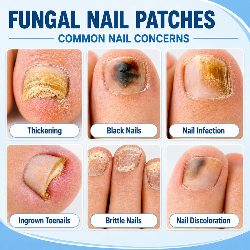 Nail Care Patches,21 Count Toenail Treatment Extra Strength Patches, Overnight Nail Appearance Care for Discolored, Thick-Looking and Rough Nails, Easy At-Home Toenail & Cuticle Routine