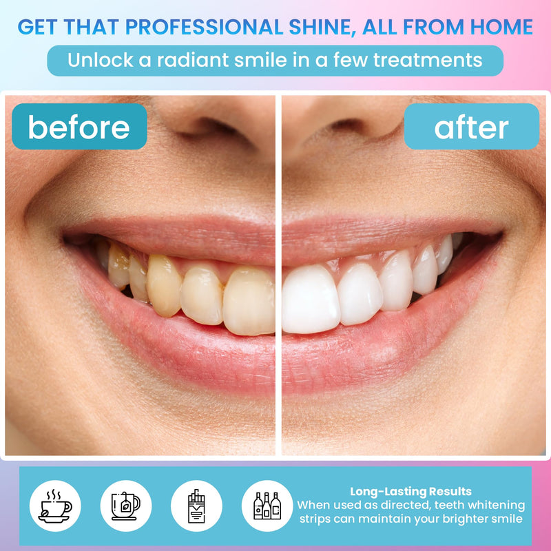 [Australia] - Teeth Whitening Strips 14 Treatments (28 Strips) - Deep Stains Removel - Enamel Safe Whitening Strips - Instant Teeth Whitening Strips 