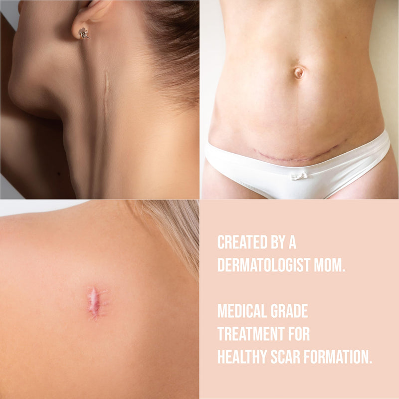 [Australia] - Quitch Silicone Scar Sheets for Surgical Scars, Silicone Scar Tape, C Section Recovery Must Haves, Tummy Tuck Recovery Must Haves, Postpartum Essentials Scar Treatment (Floral) 4x150cm Floral 