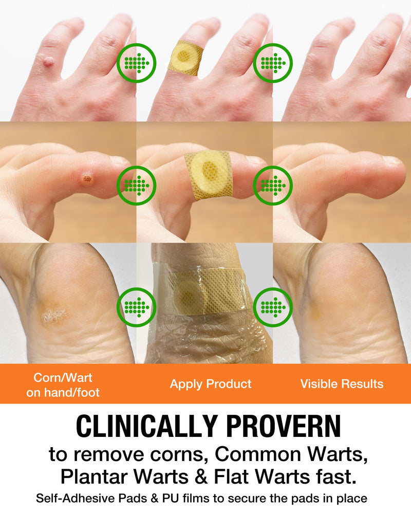 [Australia] - Wart Corn Remover Pads for Feet: 42 Pack 40% Salicylic Acid Extra Strength Bandages for Plantar Warts Corns Small Callus on Feet Hands Toes - Safe Effective Treatment for Adults Children (42 Pads) 42 Pads 