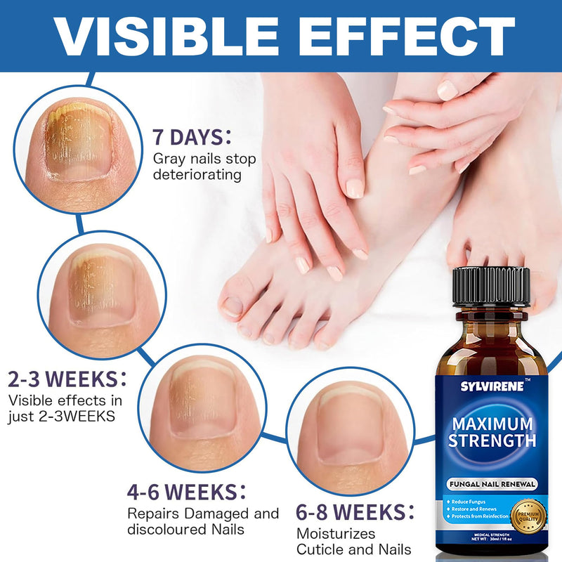Extra Strength Toenail Fungus Treatment 1oz, Restore Yellow Nails | For Toenails & Fingernails, Gentle Non-Irritating, Precision Brush Applicator, Fast-Absorbing, Athlete's Foot Relief