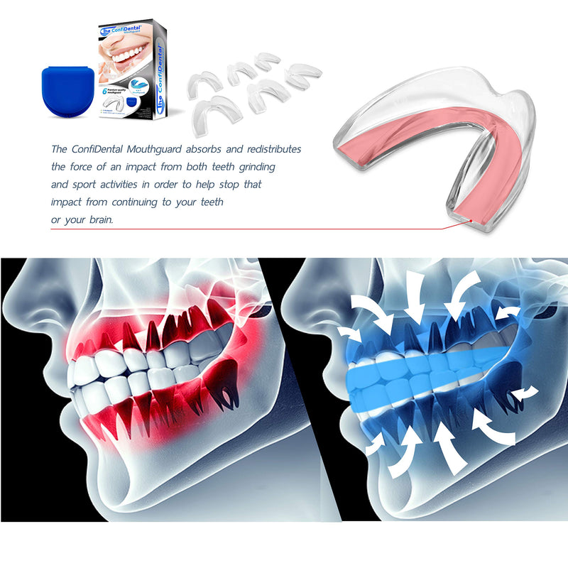[Australia] - Pack of 6 Moldable Mouth Guard for Teeth Grinding Clenching Bruxism, Sport Athletic, Whitening Tray 7 Piece Set Old Black 