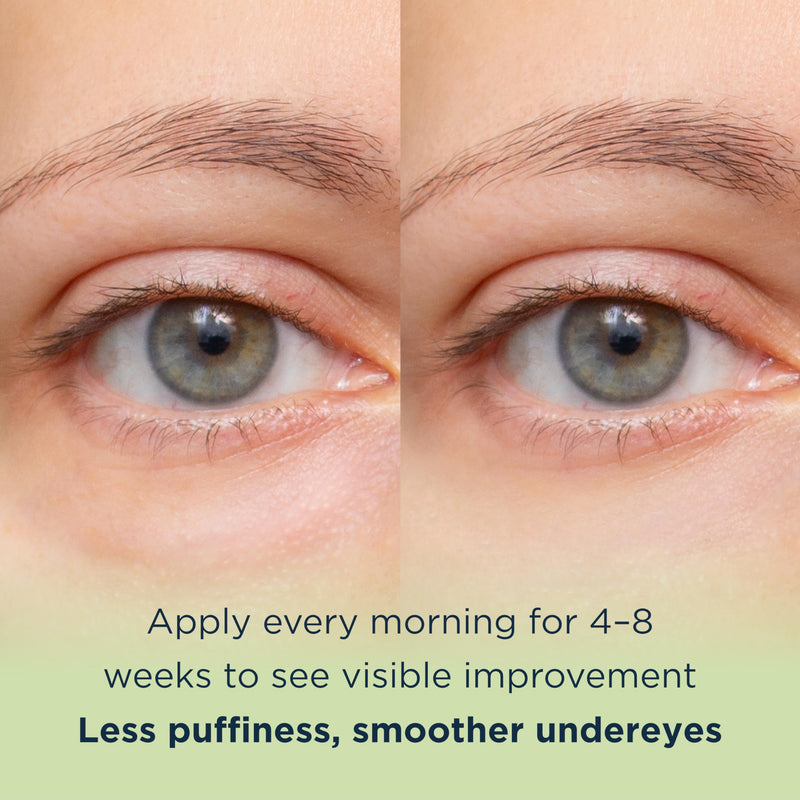 Korean Vitamin C Under Eye Brightener for Dark Circles 0.5 Floz. | Under Eye Brightener with Caffeine for Puffiness and Bags, Hydrating Vitamin C and Caffeine Eye Cream for Dark Circles