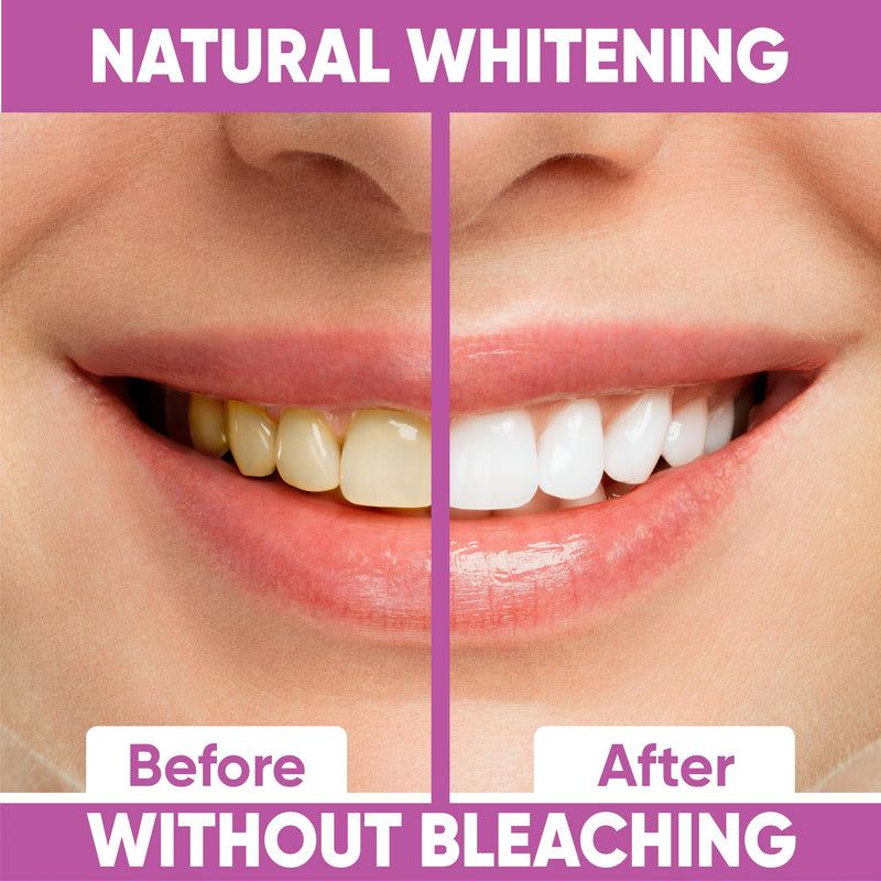 [Australia] - Gentle Teeth Whitening Strips - (28 Stripes) Bleaching Teeth Free of Peroxide for a Radiant Smile - Gentle Tooth whitening Mint 