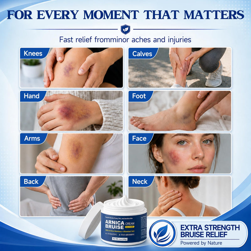 Lea-power Arnica Bruise Cream Extra Strength – Fast-Acting Arnica Montana with Vitamins C & E for Bruising, Swelling, Joint & Muscle Soreness – Hydrating Moisturizer for Face & Body 4 Ounce (Pack of 1)