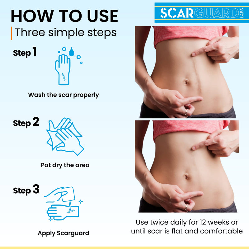 [Australia] - Invisible Brush-On Silicone Sheet with Vitamin E - Scar Removal for Keloids, Burn Scars, Surgery Scars, Stitches, Cuts - No Ugly Scar Sheets, Cream or Messy Scar Gel Needed 