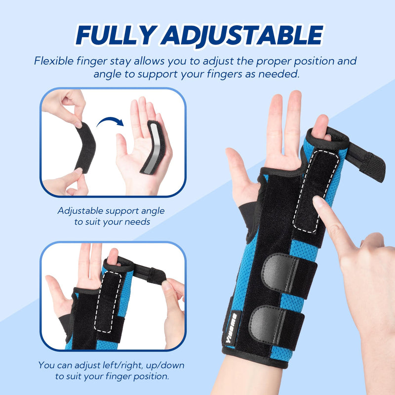 Boxer Fracture Splint, Ulnar Gutter Splint Right Hand, the 4th and 5th Metacarpal Finger Splint Hand Brace, Boxer Orthosis Hand & Wrist Brace for Women & Men, Left, L