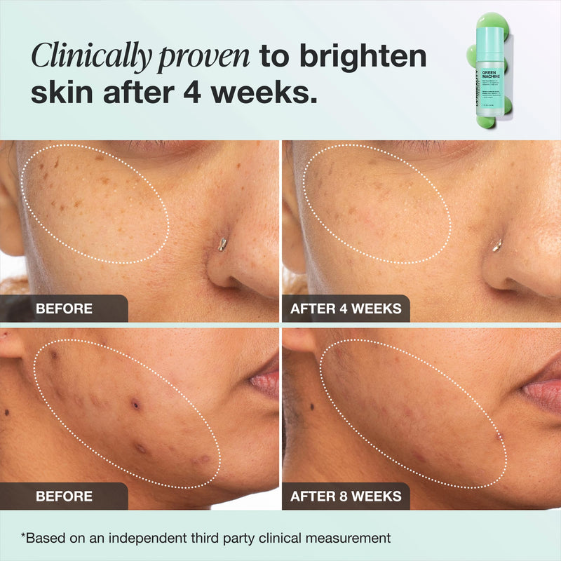 INNBEAUTY Project Green Machine Vitamin C Serum Refill, 1 oz | Refill targets dark spots, hyperpigmentation and uneven tone