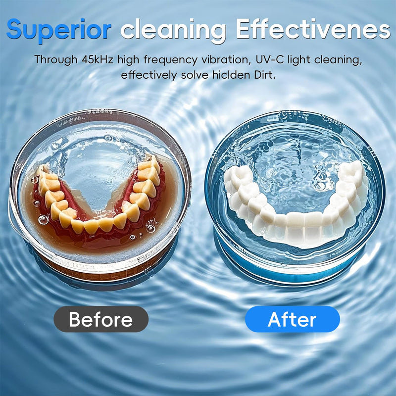 [Australia] - Professional Dental Ultrasonic Cleaner Machine - 200ML Denture, Retainer, Aligner, Night Guard & Mouth Guard Cleaner - Deep Cleaning with Protection Design for Braces, Oral Care & Dental Trays 