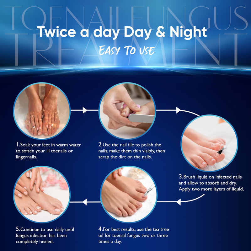 Maximum Strength Toenail Fungus Treatment with 10% Undecylenic Acid - Professional Antifungal Nail Solution for Severe, Thick & Brittle Nails 30ml