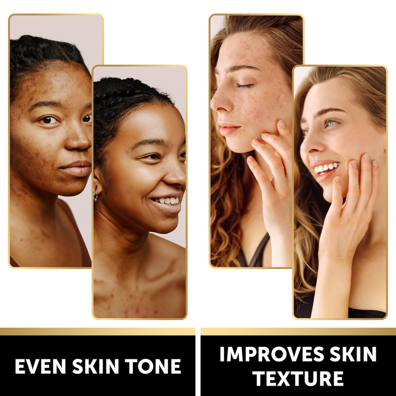 VALITIC Kojic Acid Soap Bars - Turmeric, Snail Mucin, Charcoal and Lemon - Holiday Skin Care Beauty Set Gift 4 Assorted Dark Spot Remover Soaps with Hyaluronic Acid, Vitamin C, Vitamin E, Shea Butter Variety Pack