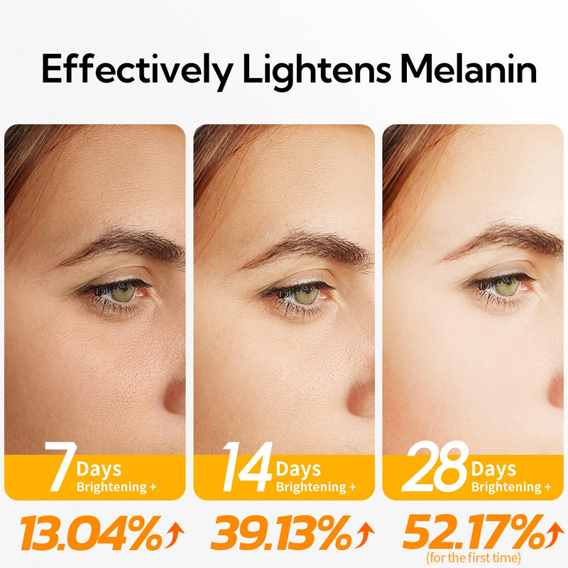 20% Vitamin C Serum For Face, 30 ML/ 1 Fl, Brightening Skin, Dark Spot Remover, Reduce Wrinkle, Anti Aging Glowing Serum, Facial Moisturizer with Niacinamide, Vitamin E, Hyaluronic Acid 1 Fl Oz (Pack of 1)