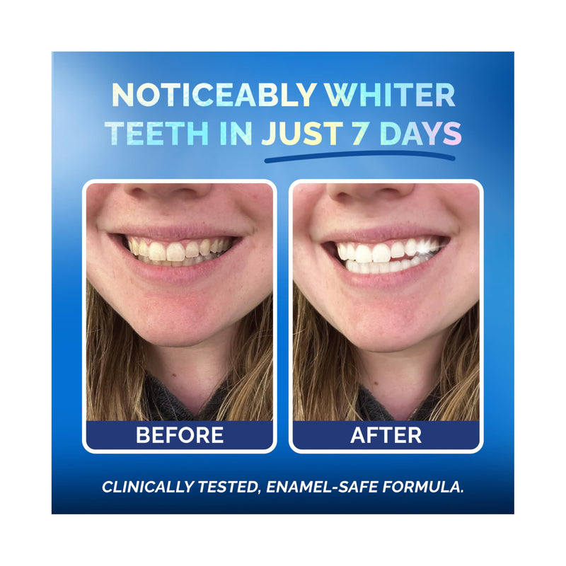 [Australia] - Whitening Strips for Sensitive Teeth 14 Treatments, Coconut – Enamel Safe, Peroxide-Free Coconut Teeth Whitening Strips with Natural Enzymes – Gentle White Stips for Sensitive Gums & Daily Oral Care 