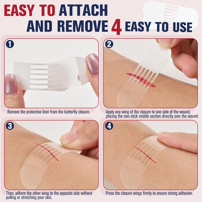 [Australia] - Emergency Wound Closure Strips - HSA or FSA Eligible - Mountree 4 Types Easy to Use Laceration Closure Kit - Stitchless & Painless Sutures Butterfly Bandaids 35PCS 