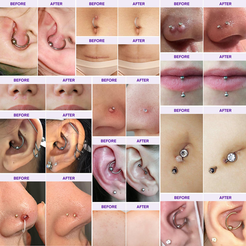 [Australia] - Piercing Keloid Bump Solution Kit | Piercing Aftercare Treatment with Piercing Bump Solution Aftercare Oil (30 mL) + Keloid Bump Removal Gel (20 g) help Softens Scar Tissue & Supports Skin Renewal 