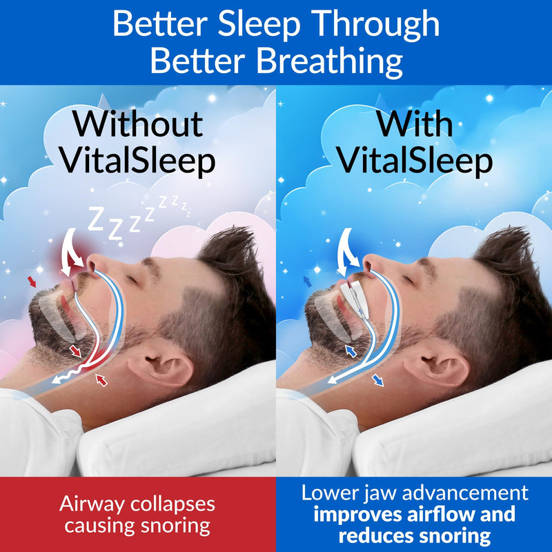 [Australia] - VitalSleep Men's Anti Snoring Mouth Guard, Adjustable Snoring Device, Custom Anti Snore Device with Blackout Sleep Mask, Snore Mouthpiece for Better Sleep, USA Made, 1 Year Warranty 