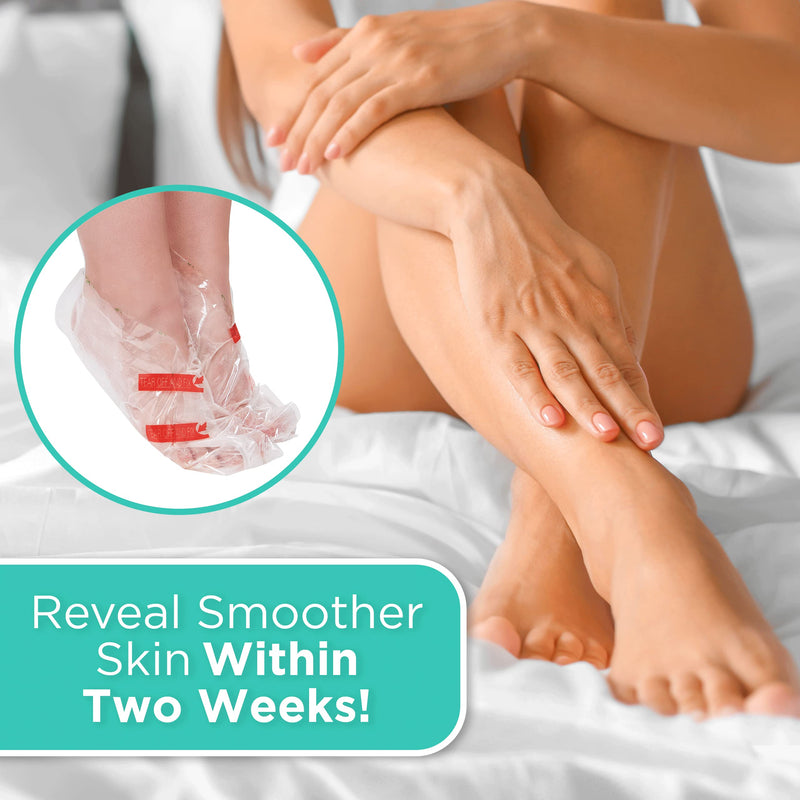 [Australia] - DERMORA Foot Peel Mask - 2 Pack of Regular Size Skin Exfoliating Foot Masks for Dry, Cracked Feet, Callus, Dead Skin Remover for Baby Soft Feet, Original Scent 2 Count (Pack of 1) Scent: Original 
