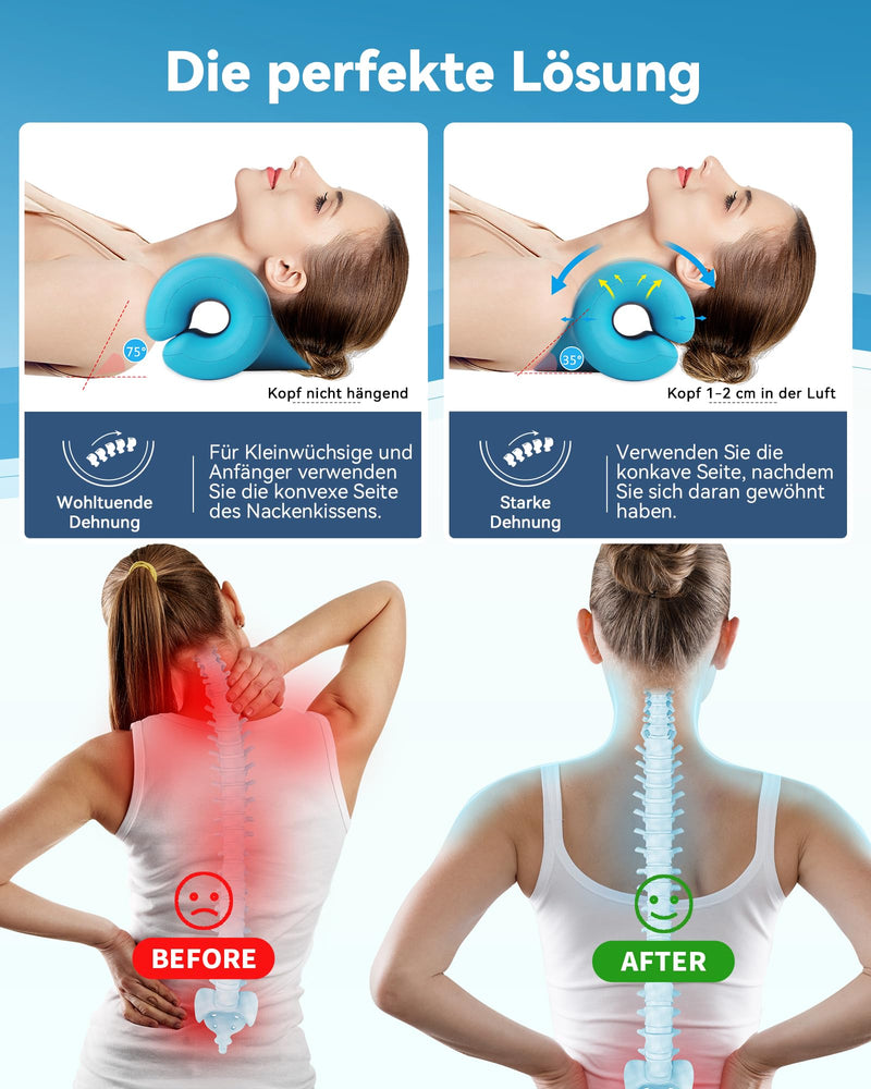[Australia] - BLABOK Neck Stretcher Cervical Spine Traction Device to Relieve Neck and Shoulder Fatigue and Pain, Neck Stretcher for Relief TMJ Pain Headache Muscle Blue 