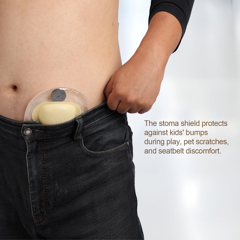 [Australia] - Stoma Guard and 50 Pairs of Stickers | Ultimate Protection for Your Ostomy Bag 