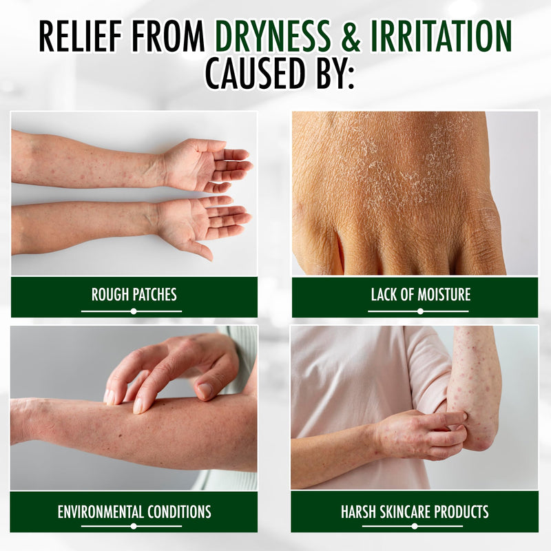[Australia] - GLY MIRACLE Moisturizing Body Cream Lotion, 16 ounce - Non-Greasy Skin Humectant for Extremely Dry Skin, Hands, Body, and Feet, Fragrance-Free with Pure Glycerin for Nourishing Hydration. Unscented 16 Fl Oz (Pack of 1) 