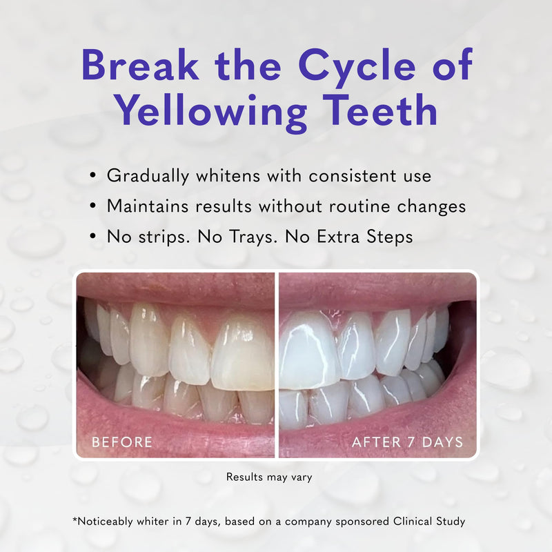 Smileactives Teeth Whitening Gel, Hydrogen Peroxide, Add to Toothpaste | Removes Coffee Stains & Discoloration, Long-Lasting Results, Whiter Smile 2 Ounce (Pack of 1)