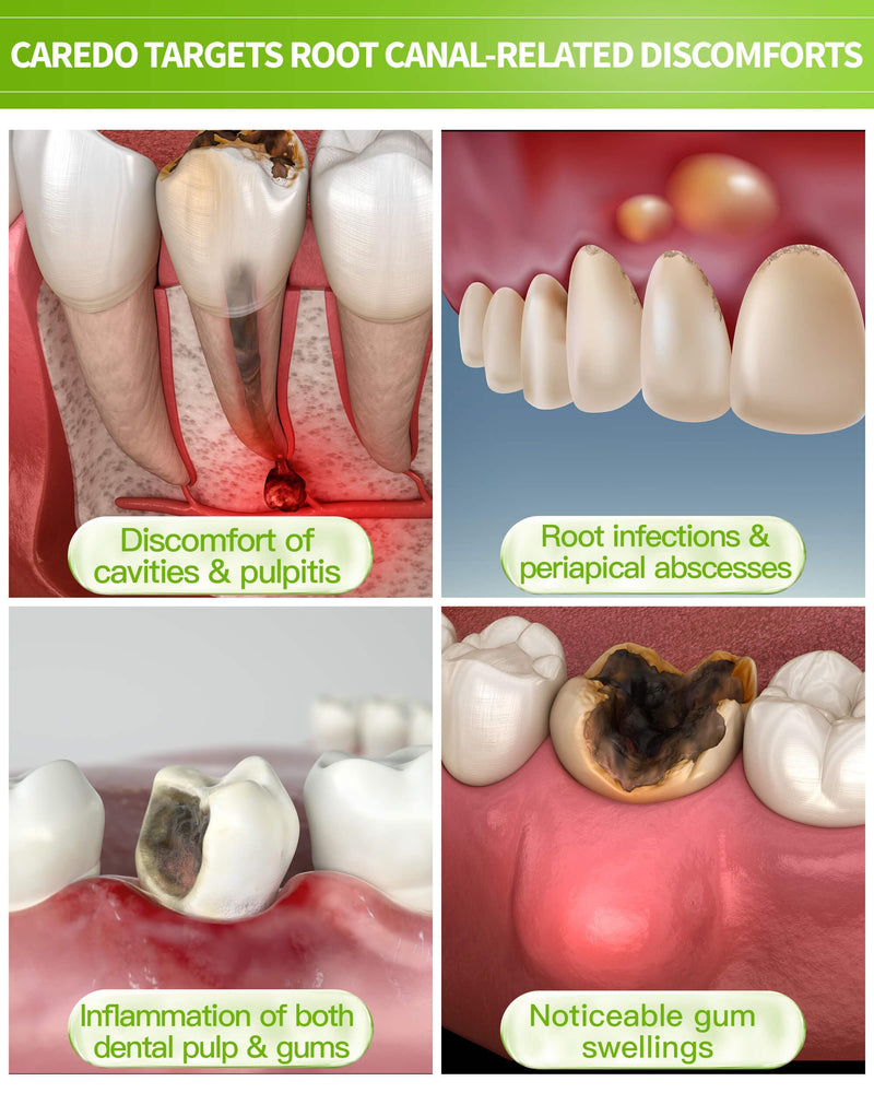 [Australia] - Toothpaste Gum Repair for Avoid Root Canal Therapy, Gingivitis Treatment for Pulpitis Discomforts and Tooth Repair, Remineralizing Hydroxyapatite Toothpaste for Root Canal Discomforts, Mint 3.52 OZ 3.52 Ounce (Pack of 1) 
