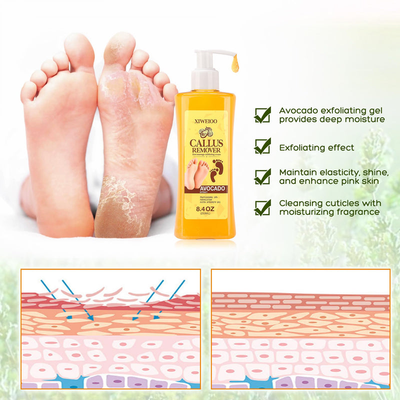 [Australia] - Foot Callus Remover Gel Kit Heel Exfoliator Dead Skin Remover Pedicure Foot Spa Products Set Home Pedicure Foot Care Spa Supplies for Rough, Dry, Cracked Skin Cracked Heel, Professional 