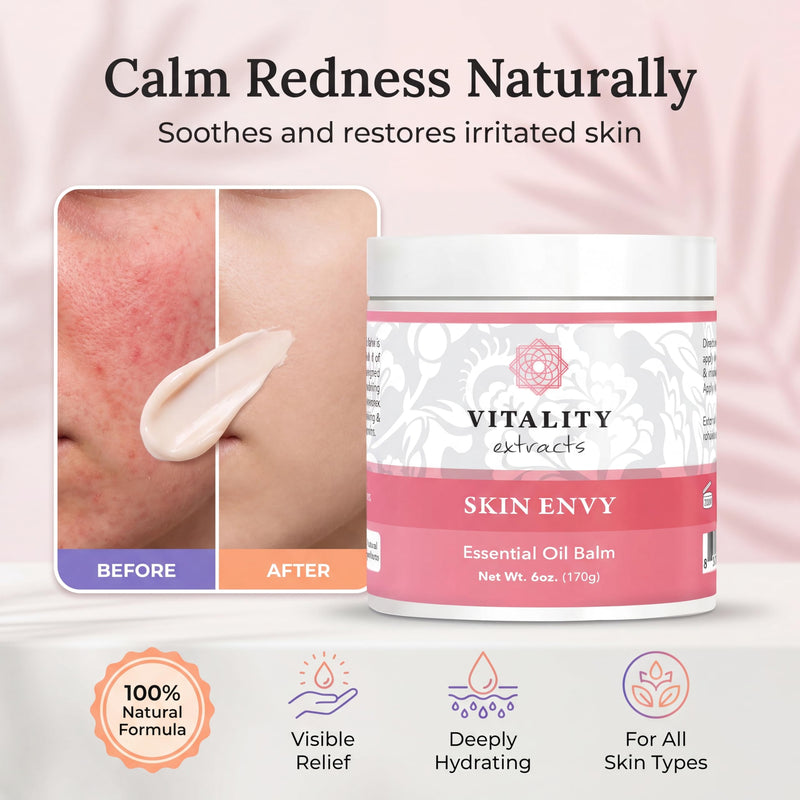 Vitality Extracts Skin Envy Essential Oil Balm - 6oz, Moisturizer, Beeswax, Vitamin A, Skin Care, All Natural, Coconut Oil