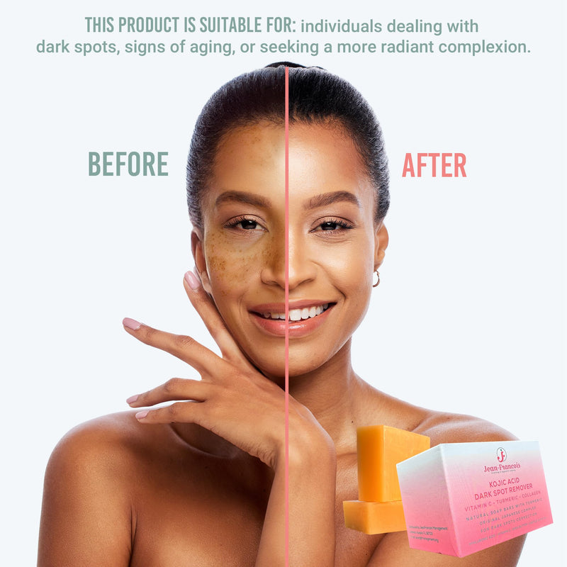 Jean-Francois Kojic Acid Dark Spot Remover Soap Bars with Vitamin C, Collagen, Turmeric - Original Japanese Complex with Hyaluronic Acid, Vitamin C, Vitamin E, Shea Butter, Castile Olive Oil (2 Pack)