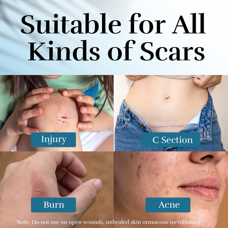 [Australia] - Advanced Scar Cream, Scar Reduction Treatment for Improves Skin Texture & Helps Remove Acne, Stretch Marks, Surgery, C Section, Burn, Keloid & Hypertrophic Scars 1.76 Oz (50g) 