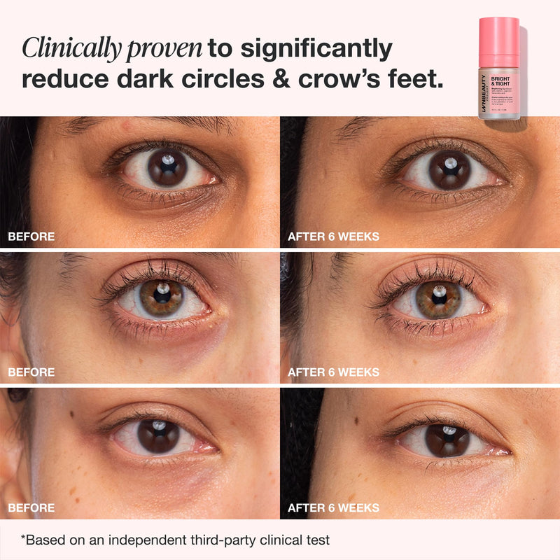 Innbeauty Project Bright & Tight Refillable Eye Cream, 0.5 oz (15 ml) | Targets dark circles and brightens with Vitamin C and caffeine