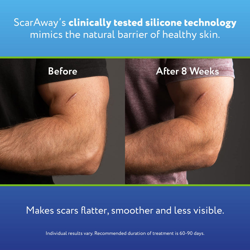[Australia] - ScarAway Advanced Silicone Scar Sheets, Medical Grade Variety Pack Silicone Strips, Scar Treatment & Prevention for Surgical, Burn, Body, Acne, Hypertrophic & Keloid Scars, 8 Reuseable Sheets 