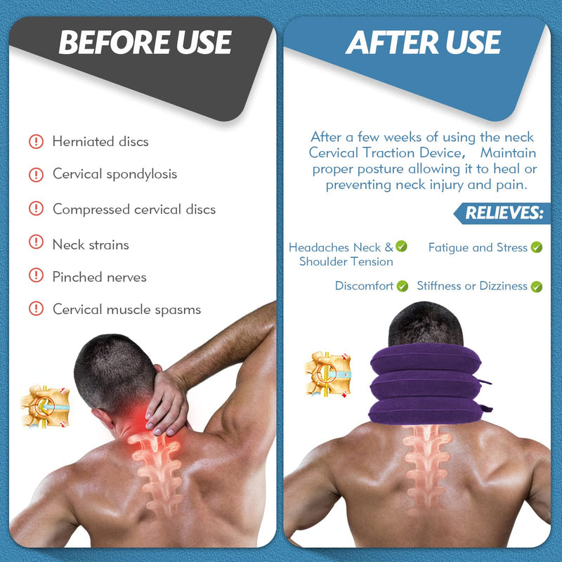 [Australia] - Neck Stretcher, Cervical Traction Device, Neck Traction Device, Neck Pain Relief, Adjustable Inflatable Neck Brace & Neck Stretcher Cervical Traction, Neck Decompression Home Use (Purple) Purple 