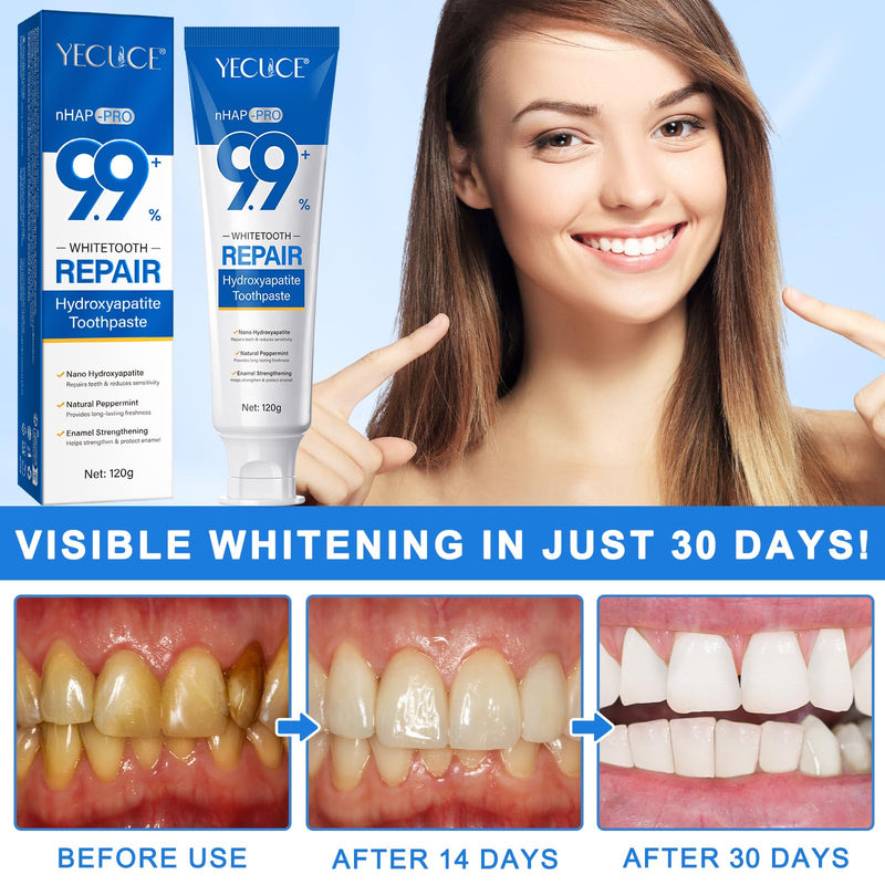 [Australia] - Hydroxyapatite Toothpaste 9.9%, (2PCS) Nano Hydroxyapatite Toothpaste for Enamel Protection and Tooth Strengthening, Gentle Mint, Fresh Breath, Daily Use for Oral Health 
