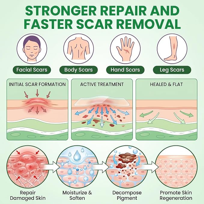 Silicone Scar Sheets, Silicone Scar Tape (1.6"x 60" Roll-1.5M), Reusable and Effective Scar Removal Sheets, Silicone Scar Removal Sheets for Surgical Scars, Healing Keloid, C-Section, Tummy Tuck