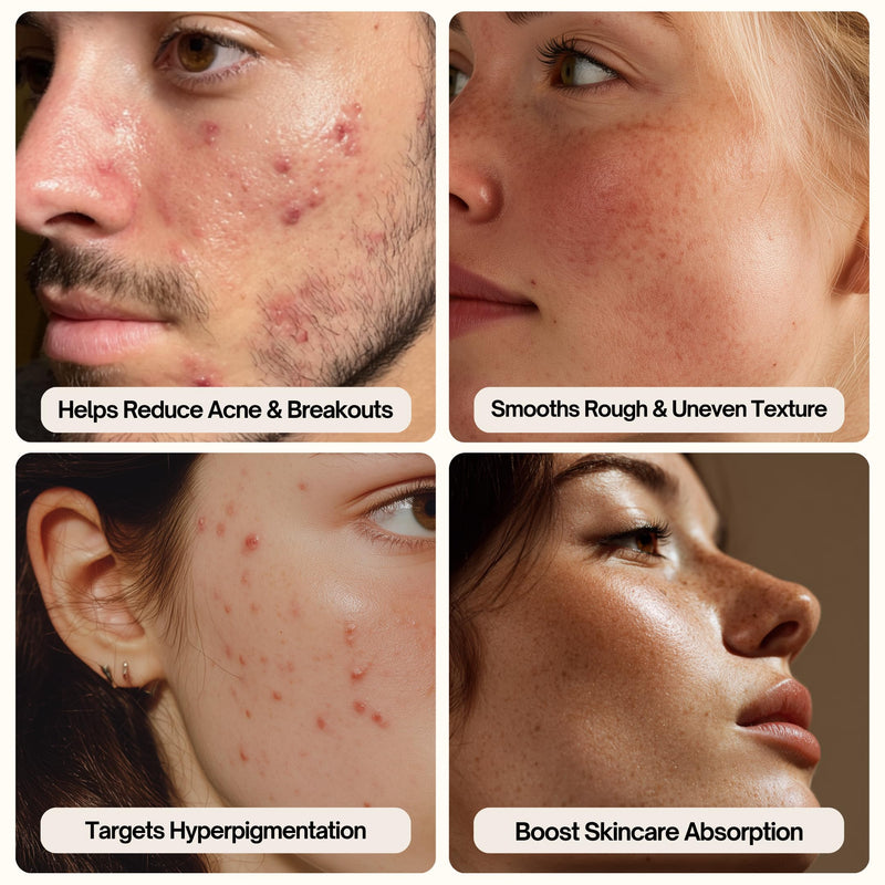 Palm Face Clean Pro⁺ - Silicon Electric Face Scrubber for Acne - IPX7 Waterproof and Rechargeable Face Exfoliator with Slip-Free Grip, 3 Speed Setting - Free from phthalates - Arctic