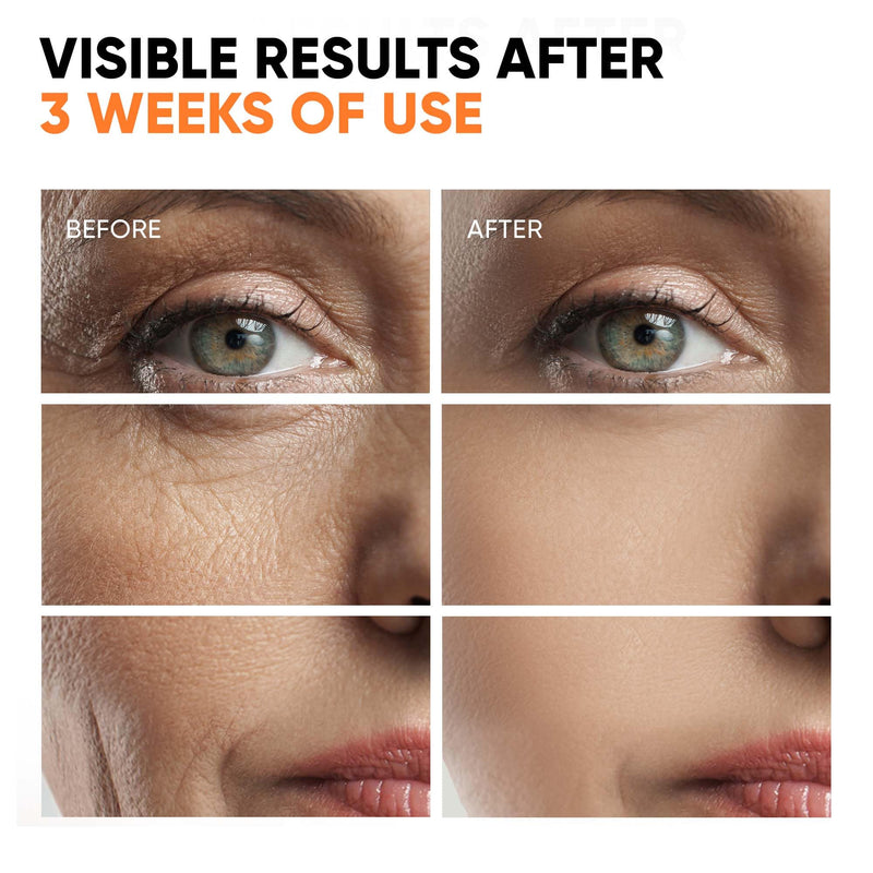 Vitamin C Serum for Face, Stem Cells, Niacinamide, Hyaluronic Acid & Vitamin E - Anti-Aging Retinol Facial Serum with Glycolic Acid & Retinal for Brightening, Hydrating & Firming Skin - Made in USA 1 Fl Oz (Pack of 1)