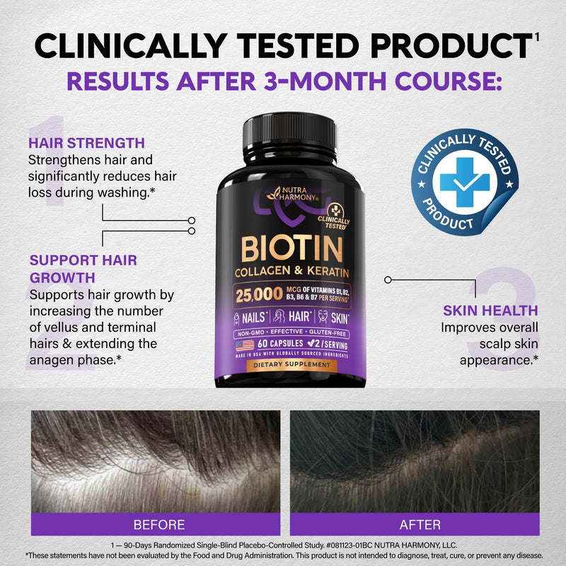 Biotin, Collagen, Hyaluronic Acid & Keratin - Hair Growth Support - 60 Caps | Hair, Skin & Nails Vitamins - Clinically Tested Supplement for Men & Women - 25000mcg Vitamins B1, B2, B3, B6 & B7 60 Count (Pack of 1)