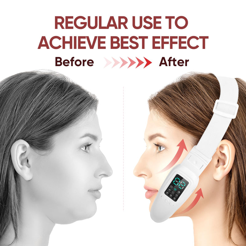 Intelligent Electric Double Chin and V-Shaped Face Machine with 8 Modes & 15 Adjustable Intensities - Women's V-Face Device White